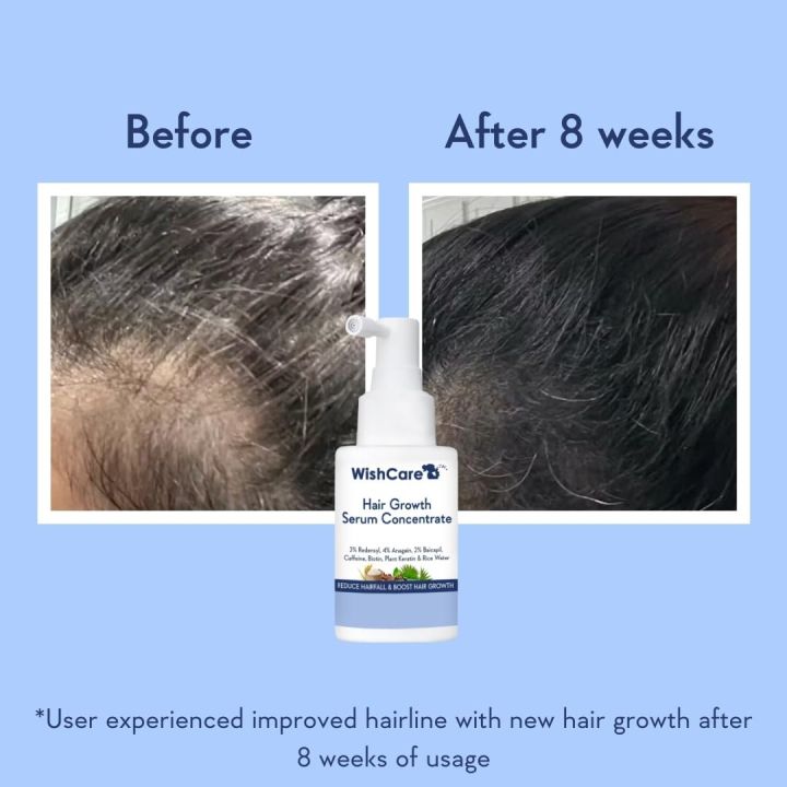 Wishcare%20Hair%20Growth%20Serum%20Concentrate%20-%20Redensyl,%20Anagain,%20Caffeine,%20Biotin,%20Keratin%20&%20Rice%20Water%2030ml%20-%20Image%203