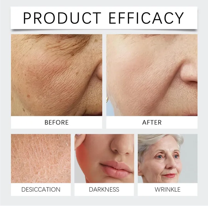 Bio%20Collagen%20Mask%20Peel-Off%20Face%20Mask%20%E2%80%93%20Anti-Wrinkle%20&%20Hydrating%20with%20Low%20Molecular%20Collagen%20&%20Hyaluronic%20Acid%20(1%20Sheet)%20BIO%20DANCE%20Mask%20Real%20Deep%20Mask,%20Hydrating%20Overnight%20Hydrogel%20Mask,%20Pore%20Minimizing,%20Elasticity%20Improvement,%20(1%20sheet)%20Collagen%20Mask%20-%20Image%206