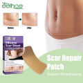 Scar Treatment Silicone Gel Sheet Eliminate Stretch Mark Scald Burn Scar Removal Acne Trauma Skin Repair Fade Surgery Scar Patch. 