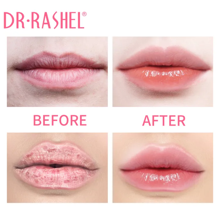 Dr.%20Rashel%20Peach%20plumping%20&%20hydrating%20lip%20balm%20-%203g%20-%20Image%205