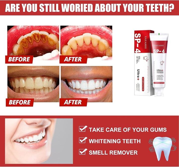 SP4%20Ultra%20Whitening%20Teeth%20%20Color%20Corrector%20Probiotic%20Whitening%20Toothpaste%20Refresh%20Mouth%20Brighten%20Remove%20Yellow%20Teeth%20/%20SP-4%20Teeth%20Whitening%20-%20Image%204
