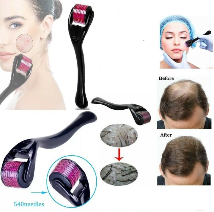 Derma%20Roller%200.5mm%20,%20Needle%20540%20Titanium%20Micro%20needles/%20Skin%20&%20Face%20Care%20/Massage%20Tools%20Professional%20-%20Image%208
