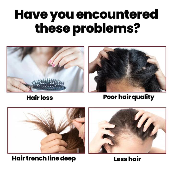 Aixuan%20%20High%20Quality%20OUHOE%20Hair%20Restoration%20Serum%20Nourishing%20Scalp%20Hair%20Growing%20Firming%20Root%20Repair%20Dry%20Damaged%20Moisturizing%20Hair%20Regrowth%20Oil%2050ML%20-%20Image%206