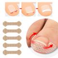 New Ingrown Paronychia Toenail Corrector Strips Anti Fungal Nail Correction Stickers Anti Infection Nail Treatment Patch. 