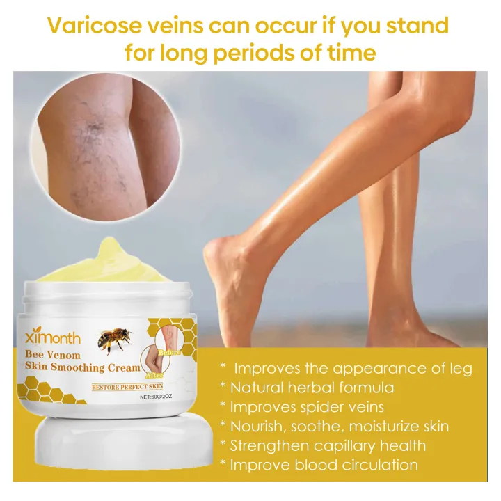Ximonth%2060g%20Bee%20Venom%20Skin%20Smoothing%20Cream%20Repair%20Vein%20Varicose%20Promotes%20Blood%20Circulation%20Reduce%20Spider%20Veins%20Leg%20Care%20Paste%20-%20Image%203