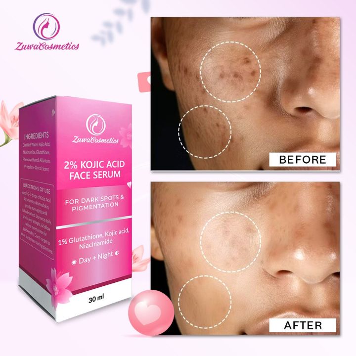 Zuwa%20Cosmetics%202%25%20Kojic%20Acid%20Face%20Serum%20with%201%25%20Glutathione%20-%20Dark%20Spot%20Corrector%20&%20Pigmentation%20Treatment%20-%2030ml%20-%20Image%202