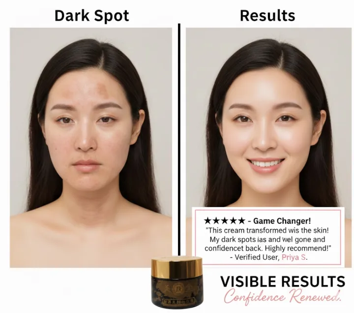 Anti%20Melasma%20(Poto),%20Freckle%20Day%20Cream%20For%20Darks%20Spot%20Free%20Skin%2030g%20-%20Image%207