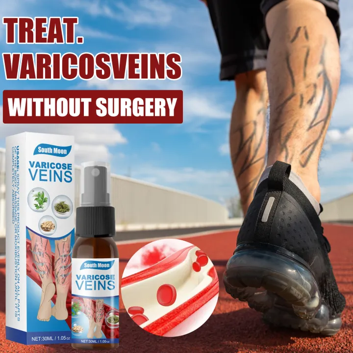 South%20Moon%20Varicose%20Veins%20Spray%20-%2030ml%20-%20Image%206