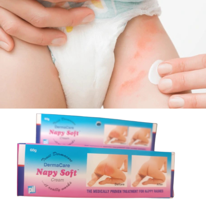 Derma Care Nappy Soft Cream | 60gm | Diaper Rash Cream for Babies | Prevents Rashes, Soothes Skin & Heals Gently | Newborn Safe | With Aloe Vera & Zinc Oxide