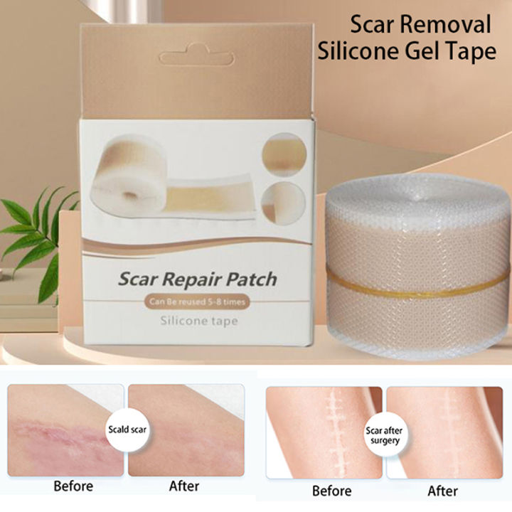 Efficient Beauty Scar Removal Silicone Gel Self-Adhesive Silicone Gel Tape Patch ZHIXING