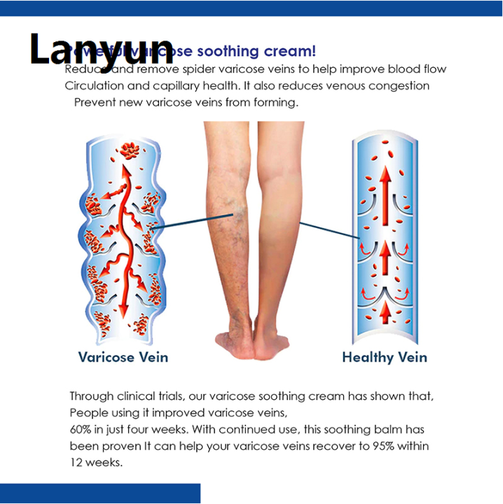 Lanyun%2020g%20Varicose%20Vein%20Relief%20Cream%20Tongmai%20Effective%20Relieves%20Leg%20Bulge%20Portable%20Pain%20Plant%20Extracts%20Treatment%20and%20Repair%20Cream%20Skin%20Care%20-%20Image%206