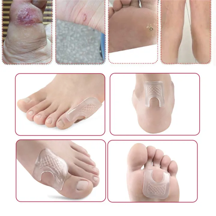 HOT NANAKOR Pexmen 2pcs/pair Waterproof Toe Cushions U-shaped Gel ...