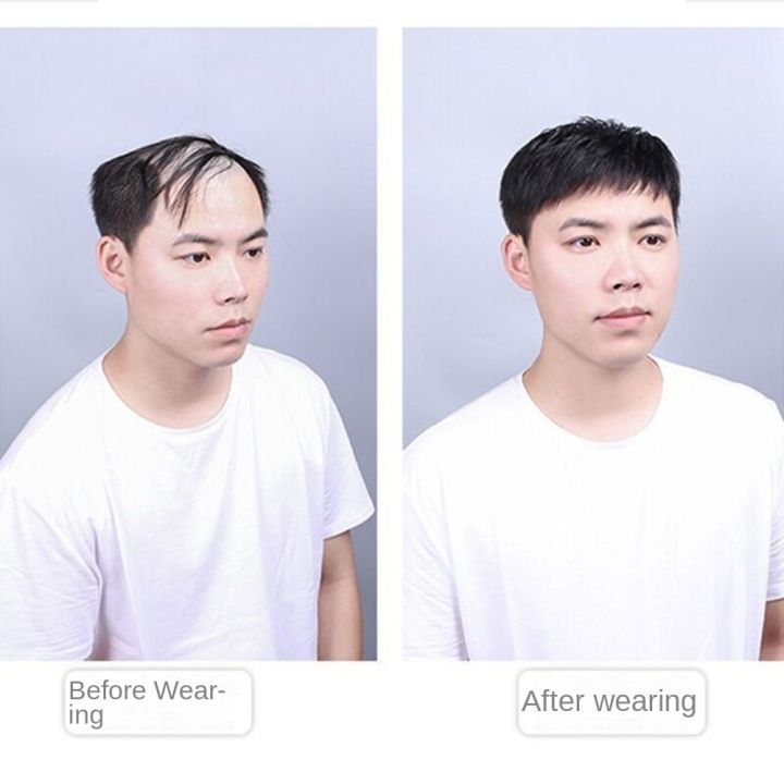 Heat%20Resistant%20High%20Hair%20Line%20Male%20Natural%20Toupee%20Balding%20Hair-Loss%20Clip-On%20Men's%20Short%20Wig%20Fluffy%20Hair%20Extensions%20Synthetic%20Hairpiece%20for%20Young%20Men%20-%20Image%207