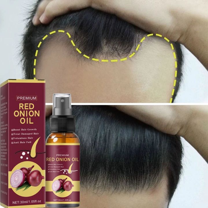 SSD%20Profesional%20Product%20Essence,%20Scalp%20Root%20Nourishment,%20Hair%20Loss,%20Hair%20Regrowth%20Mist%20Essence,%20Fast%20Hair%20Growth,%20Anti-Repair%20Treatment,%20Hair%20Care%20-%20Image%206