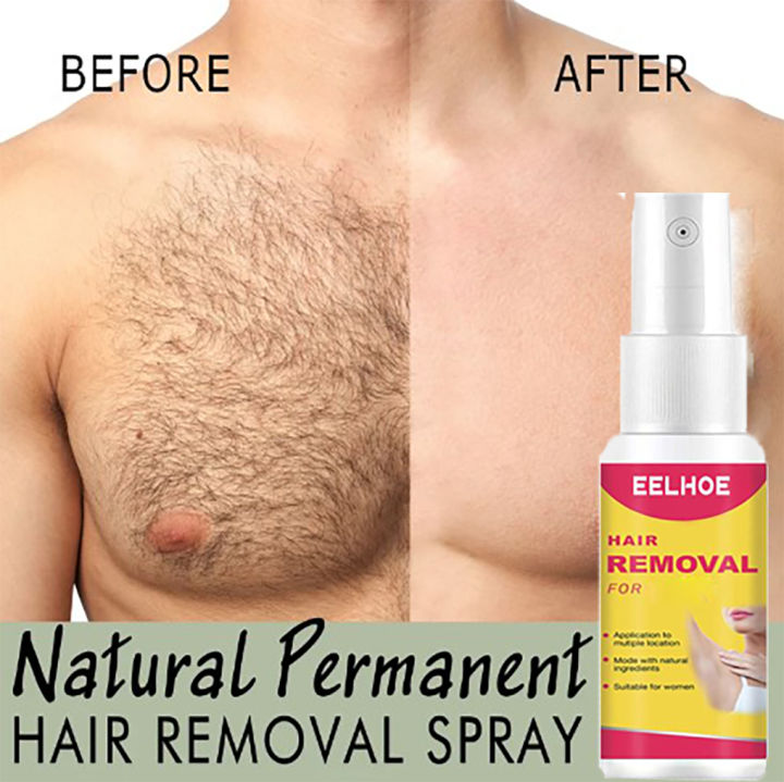 Eelhoe Hair Removal Spray