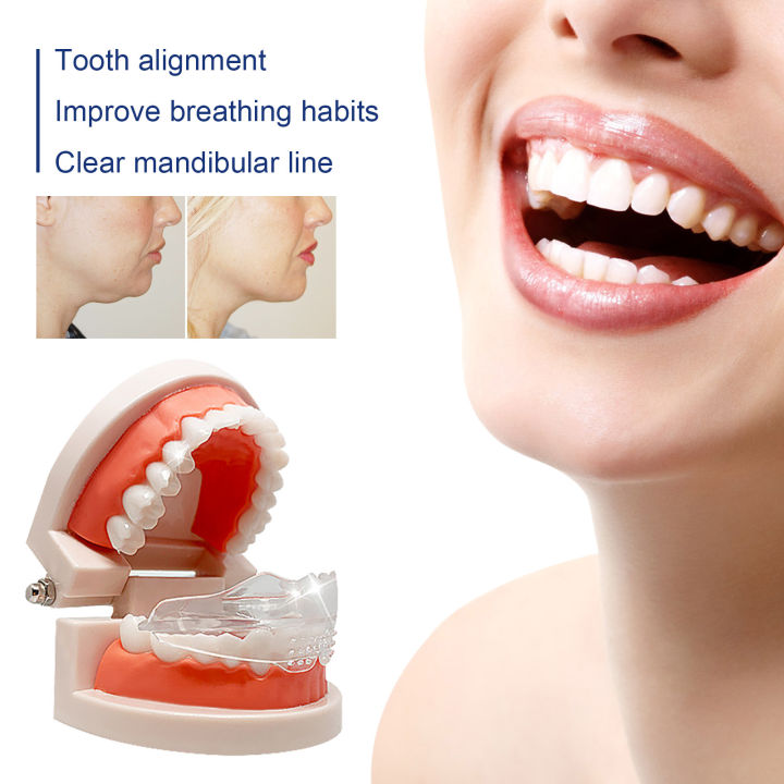 EELHOE%20Oral%20Care%20Brace%20Repairs%20Back%20Jaw%20Retraction%20Misaligned%20Teeth%20Deformity%20Buck%20Jaw%20Adjustment%20Brace%20-%20Image%202