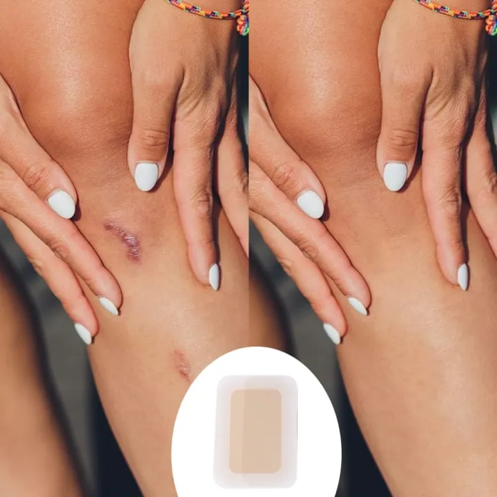 Tattoo%20Flaw%20Concealing%20Tape%20Breathable%20Cover%20Up%20Concealer%20For%20Tattoo%20Scar%20Nursing%20Cover%20Up%20Sticker%20Waterproof%20Skin%20Protector%20Shields%20-%20Image%204