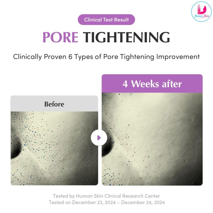 EQQUALBERRY%20Purple%20PDRN%20Pore%20Minimizing%20Serum%20%5B30ml%5D%20By%20Dream%20Skin%20Nepal%20-%20Image%207