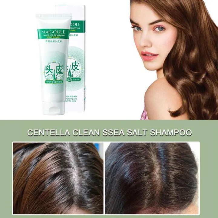 Maigoole%20Scalp%20Shampoo%20Scalp%20Shampoo%20Conditioner%20Deep%20Cleaning%20Scalp%20Refreshing%20Control%20Oil%20For%20Men%20Women%20W3c5%20-%20Image%205