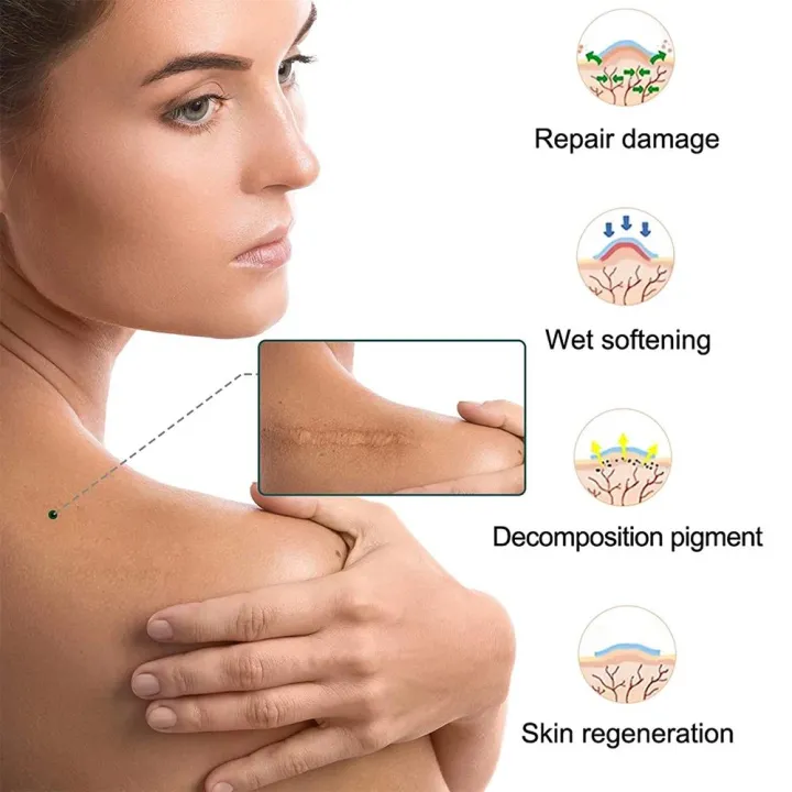 1Roll%20Professional%20Silicone%20Scar%20Sheets%20(Scar%20Tape%20-%20150cm)%20Scars%20Treatment%20-%20Reusable%20Silicone%20Scar%20Strips%20Type%20for%20Keloid,Burn%20-%20Image%203