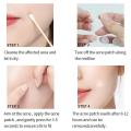 120pcs Invisible Acne Pimple Patch Professional Face Skin Care Repair Acne Healing Absorbing Spot Sticker for Men Women. 