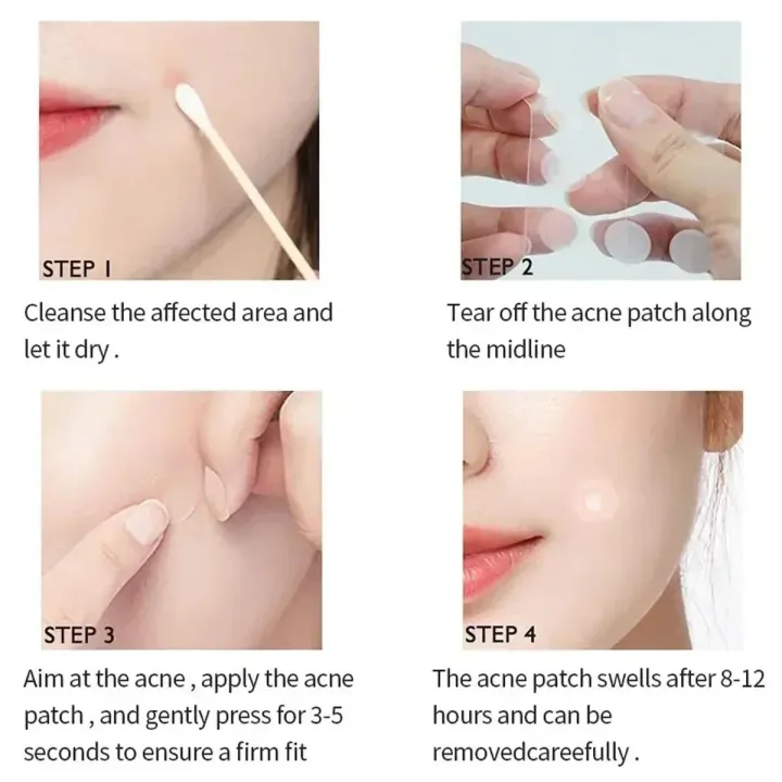 120pcs%20Invisible%20Acne%20Pimple%20Patch%20Professional%20Face%20Skin%20Care%20Repair%20Acne%20Healing%20Absorbing%20Spot%20Sticker%20for%20Men%20Women%20-%20Image%202