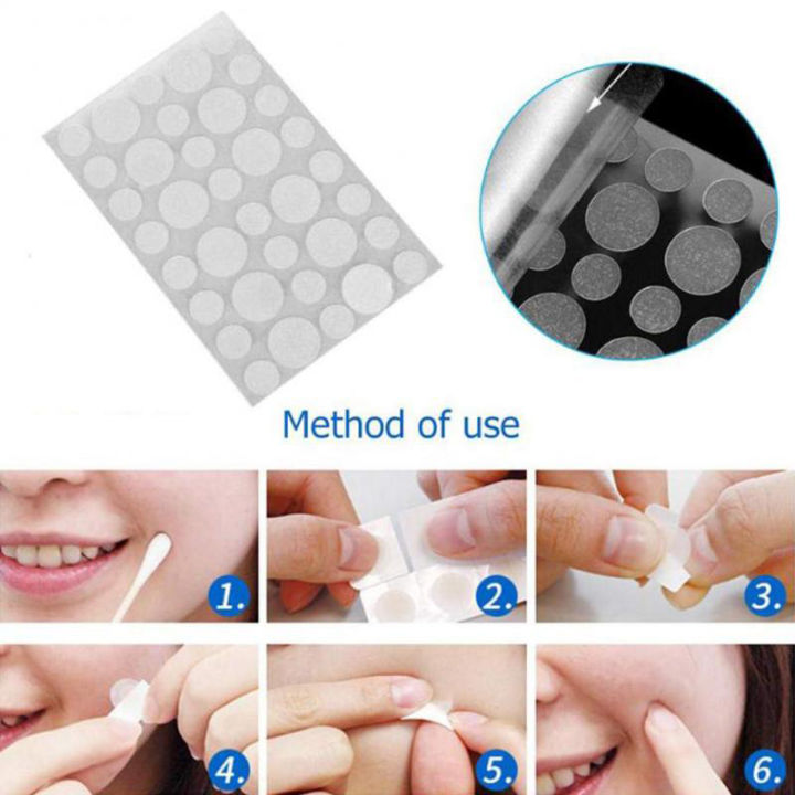 36Pcs%20Skin%20Tag%20&%20Acne%20Patch%20Hydrocolloid%20Acne%20and%20Skin%20Tag%20Remover%20Patches%20-%20Image%208