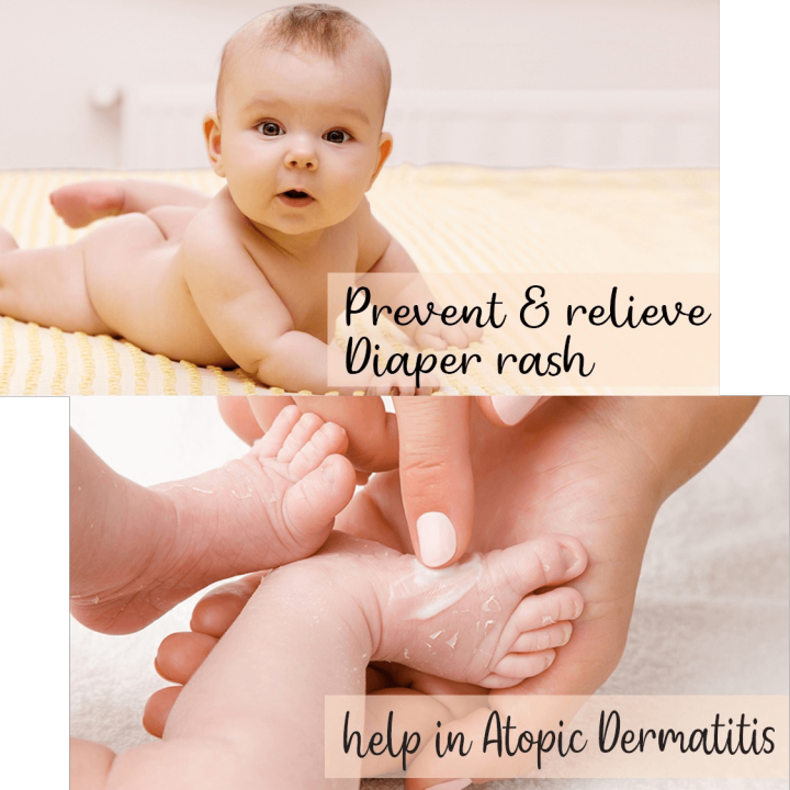 Boroline%20Ayurvedic%20Antiseptic%20Cream%20%7C%20100g%20Jumbo%20Pack%20%7C%20Perfect%20All%20Rounder%20Cream%20-%20Image%204