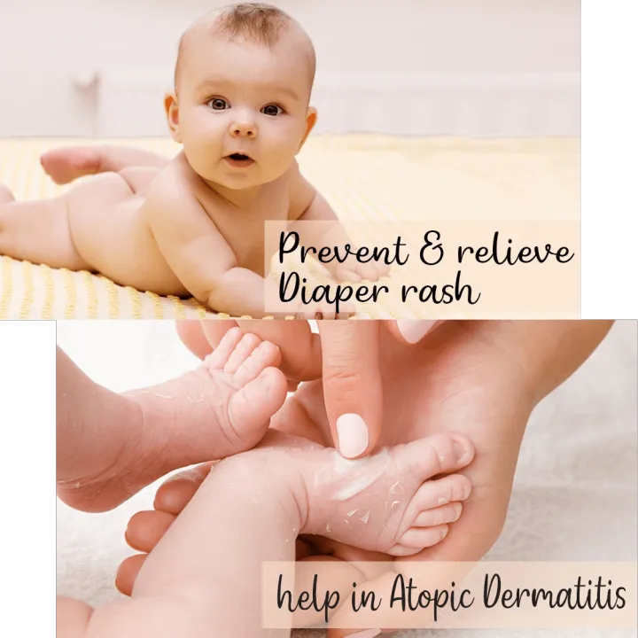 Boroline%2020g%20%7C%2050%20Tubes%20%7C%20Antiseptic%20Ayurvedic%20Cream%20%7C%20Super-Portable%20%7C%20From%20HyperMart%20%7C%20Hyper%20Mart%20%7C%20Election%20%7C%20buy%20during%20election%20commission%20nepal%20-%20Image%208