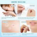 99 Mall Offer 30 PCS Waterproof Salicylic Acid Pimple Patch – Acne Spot Treatment & Skin Repair By 99 Stores. 
