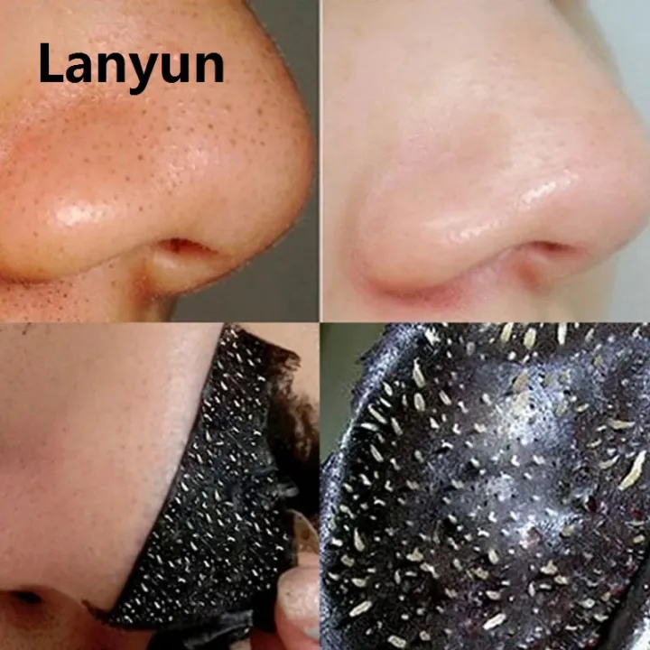 Lanyun%201PC%20Blackhead%20Remover%20Face%20Mask%20Cream%20Oil-Control%20Nose%20Black%20Dots%20Sales%20promotion%20Mask%20Acne%20Deep%20Cleansing%20Beauty%20Cosmetics%20Women%20Skin%20Care%20-%20Image%205