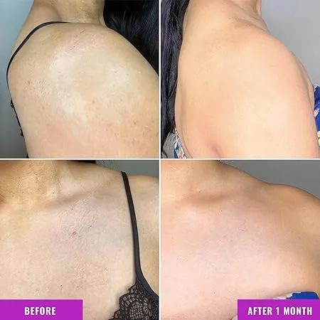 Good%20Molecules%20Discoloration%20Correcting%20Body%20Treatment%20Serum%20120ml%20-%20Image%204