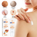 Anti Warts Fast Penetrates Natural Wart Removal Cream 20g. 