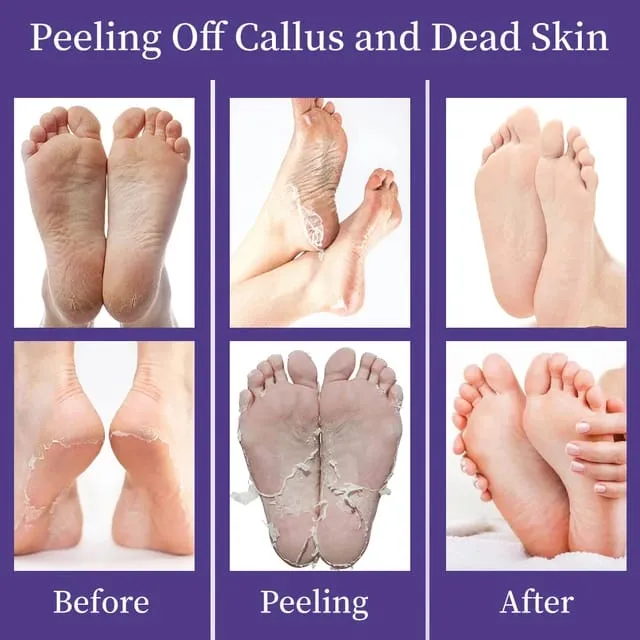 Mooyam%20Skin%20Care%20Hydrating%20Exfoliating%20Lavender%20Foot%20Mask%2040gm%20-%20Image%206