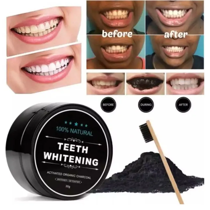 Perfect%20Smile%20Stain%20Remover%2020G%20Black%20Charcoal%20Miracle%20Tooth%20Whitening%20Powder%20By%20Godam%20Online%20-%20Image%202