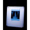 Led  X-Ray View Box Single Film With Dimmer. 