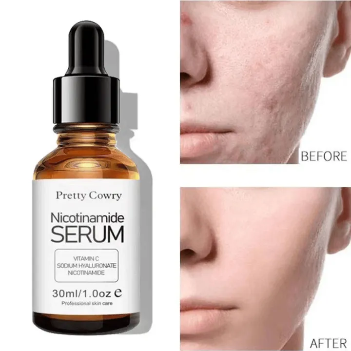 Pretty%20Cowry%20Nicotinamide%20Serum%20100%25%20Natural%20%7CFor%20all%20Skin%20Type%7C%2030%20mL%20%7C%20-%20Image%204