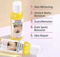 Mooyam Extra Strong Peeling Oil, Exfoliating Yellow Oil for Dark Skin, Yellow Peeling Oil for Extra Strength Exfoliation, Exfoliating Peeling Solution for Body All Skin Types 110ml. 