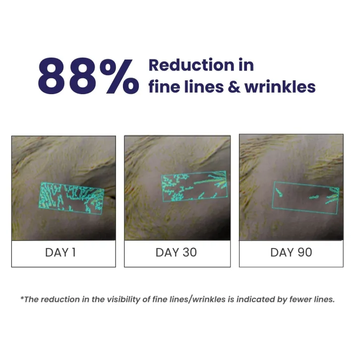 Re'equil%200.1%25%20Retinol%20Night%20Cream%20%7C%20Repairs%20Wrinkles%20&%20Fine%20Lines%20%7C%20Improves%20Skin%20Firmness%20%7C%20Beginner%20Friendly%20%7C%20All%20Skin%20Types%20%7C%20Krisa%20Beauty%20%7C%2030G%20-%20Image%204