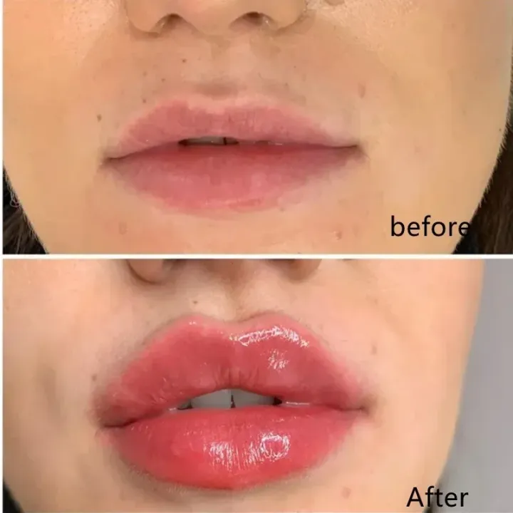 99%20Mall%20Offer%201-Piece%20Portable%20Lip%20Plumper%20%E2%80%93%20Ginger%20&%20Mint%20Infused%20Lip%20Care%20Serum%20for%20Fuller,%20Softer,%20and%20Hydrated%20Lips%20By%2099%20Stores%20-%20Image%205
