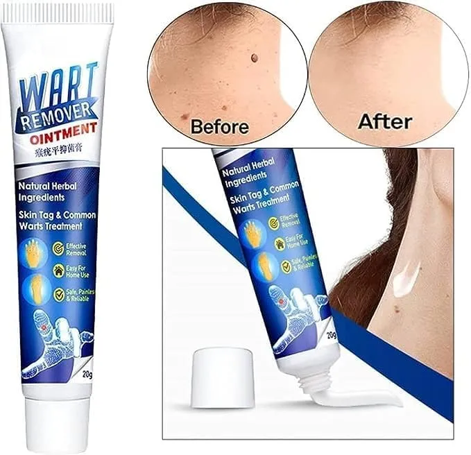 Wart%20Remover%20creaml%20%7C%20Skin%20Tag%20Remover%20cream%20%7C%20massa%20remover%20ointment%20for%20skin%20%7C%20Painless%20Wart%20&%20Skin%20Tag%20Removal%2020g%20-%20Image%203