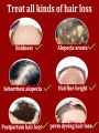 Hair growth essential oil, repair hair loss and baldness, restore thick hair. 