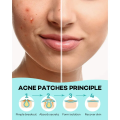 200 Patches Acne Cover  Pimple Patches for Face, Hydrocolloid Acne Patches, Cute Star Zit Covers for Face. 