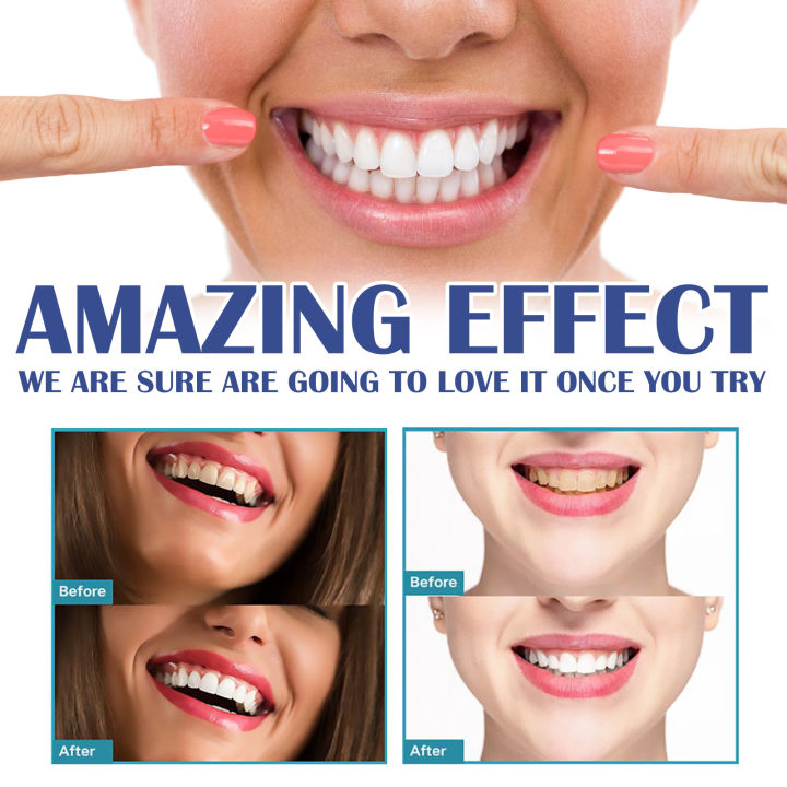 West%20Month%20Gum%20Care%20Gel%20Relieves%20gum%20recession,%20swelling%20and%20pain,%20cleans%20plaque%20stains%20and%20whitens%20teeth%20-%20Image%202