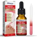 Ingrown Toenail Pain Relief Drops - 30ml. 