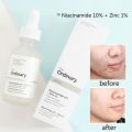 Niacinamide Serum In Nepal 30ml - Treats Acne, Skin Redness, Pimples & Pores. 