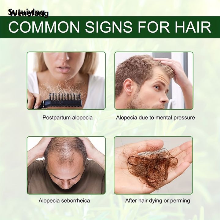 Wenefang%20Sutuiying%20Rosemary%20Mint%20Hair%20Growth%20Oil%20Preventing%20Hair%20Dryness%20Split%20Moisturizing%202025%20Fashion%20Gentle%20Nourishing%20Soft%20Glossy%20Organics%20Hair%20Care%20Oil%20-%20Image%204
