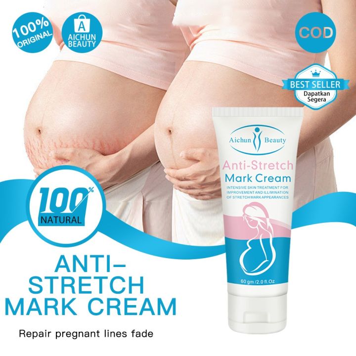 Aichun Beauty Whitening Stretch Marks Repair Cream Scar Repair Maternity Repair To Nourishing Cream Moisturizer Growth Lines Massage Skin Body-60g
