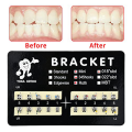 10Pack Model Metal Brackets Braces 018 Slot 345 Hooks Tooth Gem Kit Tooth Braces. 