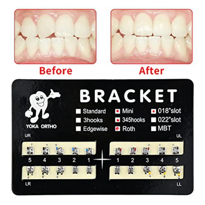 10Pack%20Model%20Metal%20Brackets%20Braces%20018%20Slot%20345%20Hooks%20Tooth%20Gem%20Kit%20Tooth%20Braces%20-%20Image%205